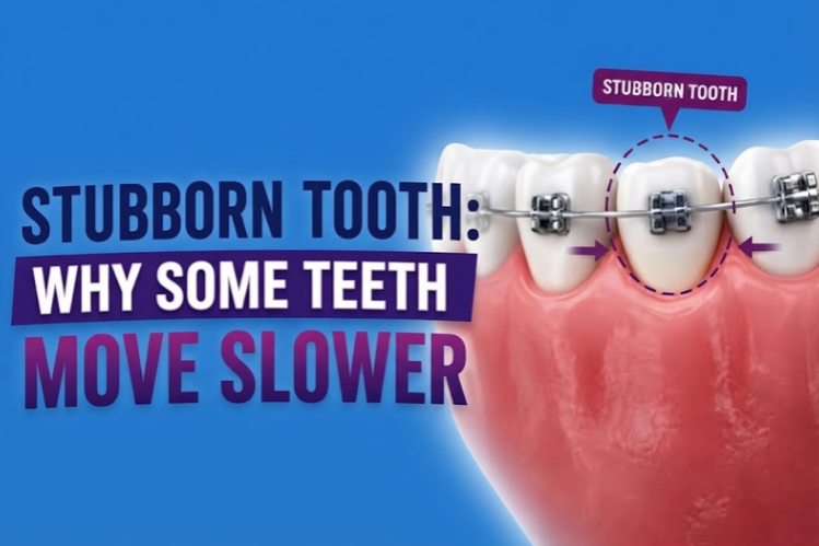 Teeth with braces showing a stubborn tooth that moves slower
