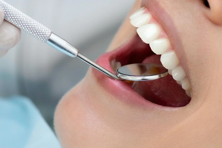 Dentist examining a smiling woman's teeth with a dental mirror
