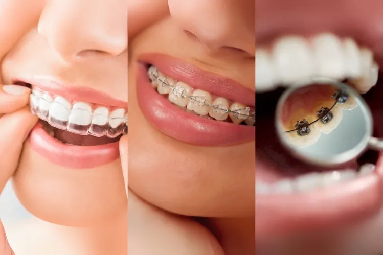 A side-by-side image of different types of braces
