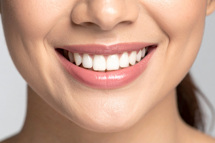 Are Teeth Whitening Treatments Permanent?