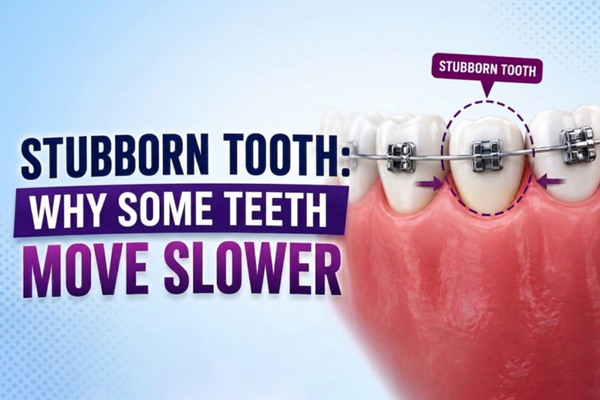 An image shows why some teeth move more slowly