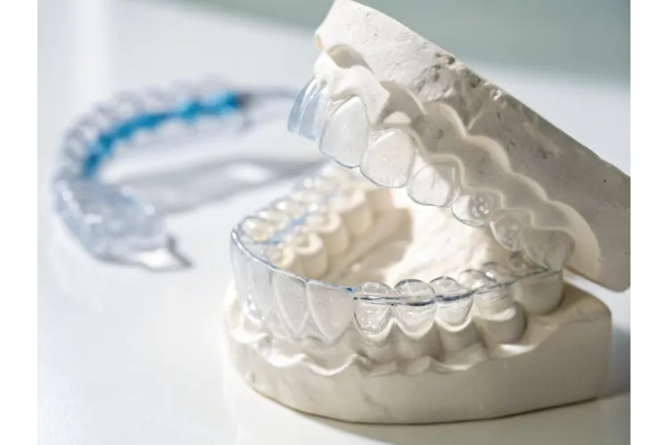What Happened to Byte Aligners? Everything You Need to Know