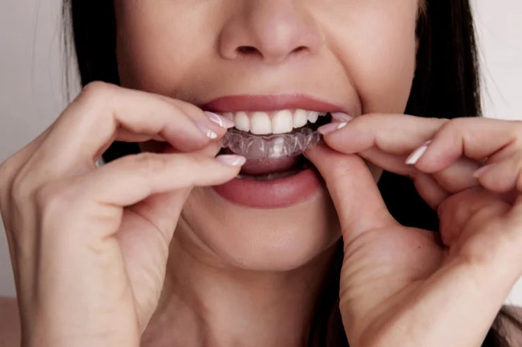 A woman putting on clear aligners 