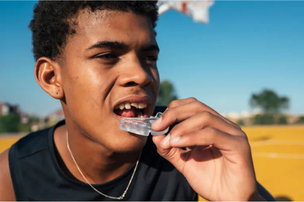 Protectores bucales: el guardaespaldas secreto de tu sonrisa