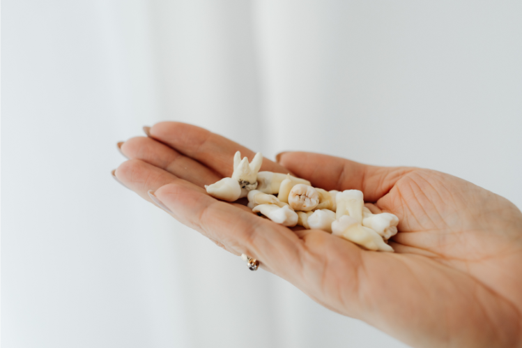 A palm holding many loose teeth 