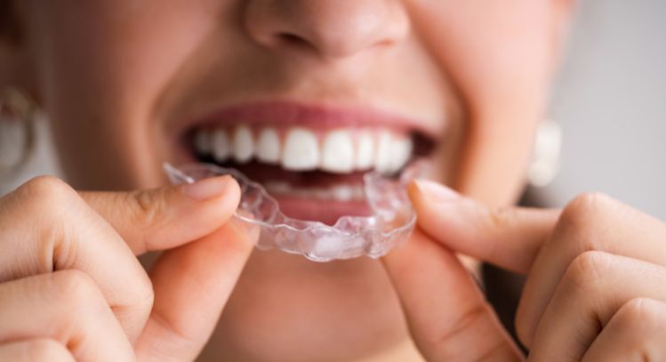 10 Tips for Maintaining Healthy Teeth and Gums While Wearing Clear Aligners