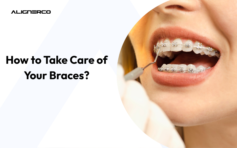  Close-up of dental braces checkup