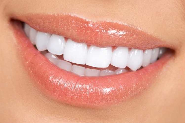 Close-up of a bright white smile after teeth whitening