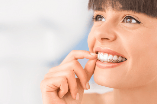 Addressing Vertical Excess or Insufficiency with Clear Aligners