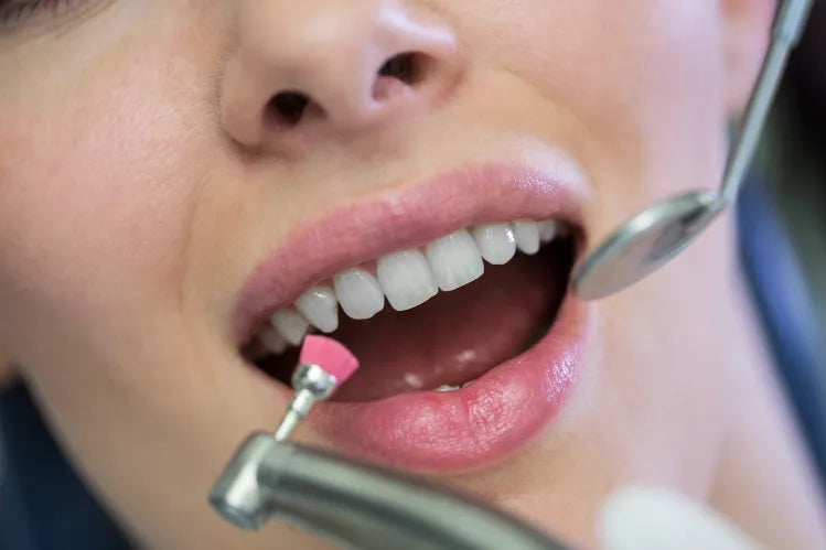 Dental Bonding Cost: What to Know before Your Procedure