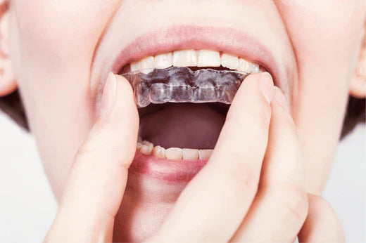 Facial harmony and invisible braces