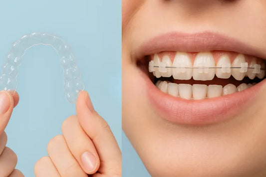 A side-by-side comparison of white braces vs clear aligners.