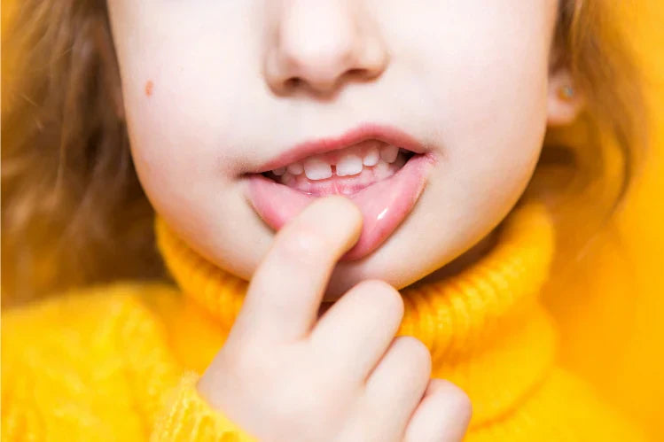 The child shows her Teeth Pathological Bite