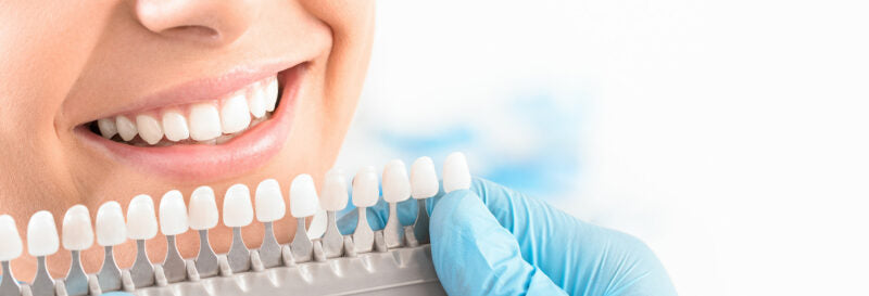 How Much Does Professional Teeth Whitening Cost?