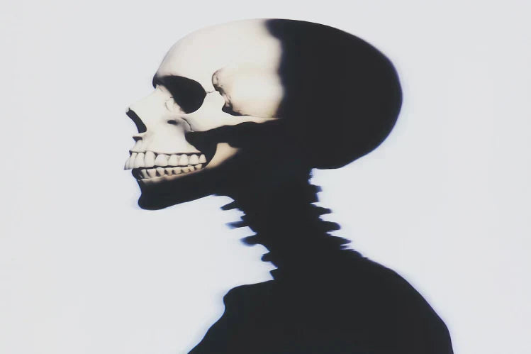  image of a skeleton with an overbite issue