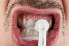 ¿El pulido de dientes es lo mismo que el blanqueamiento dental?