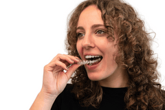 Braces Kit vs. Aligners Kit: Is There a Difference?