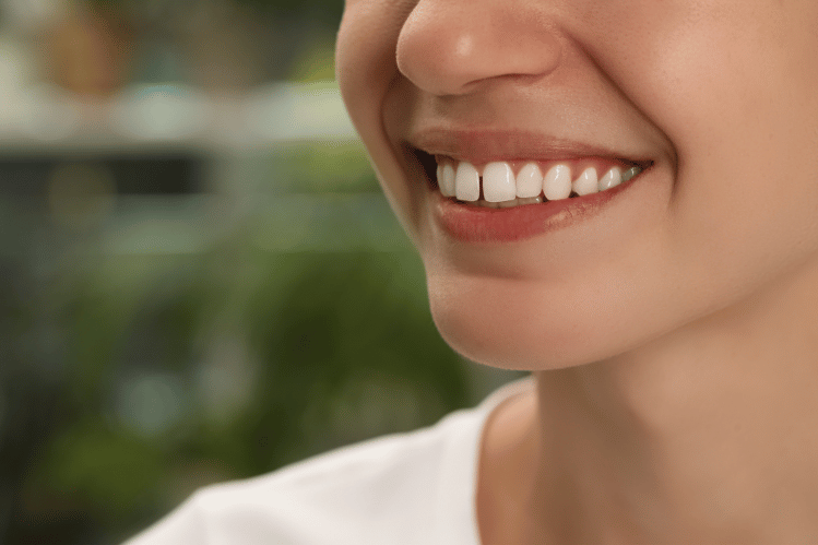 Clear aligners for diastema