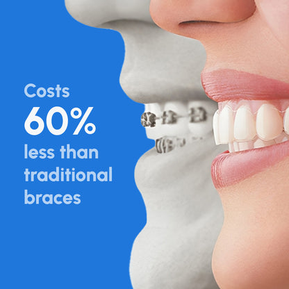 cost braces