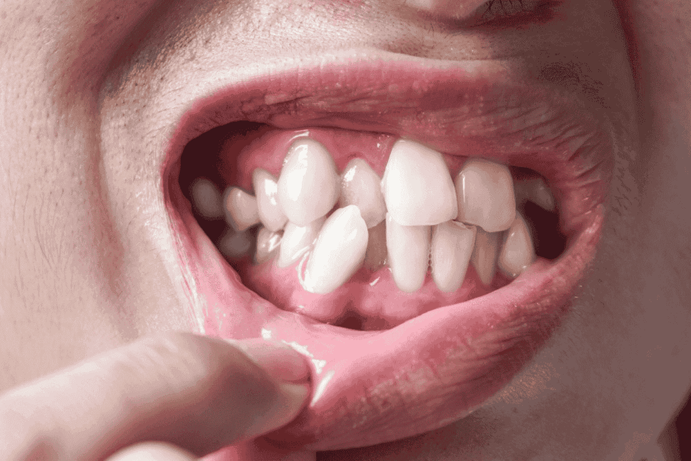 What Will Happen If It's Left Untreated?