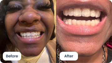 Lakeisha Eleby Considers Choosing ALIGNERCO Her Best Decision