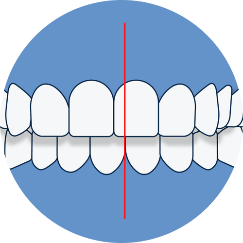 Desplazamiento de la línea media