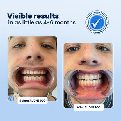 SmileFlex