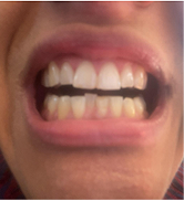 Smile Step 6