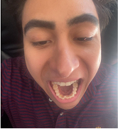 Smile Step 7