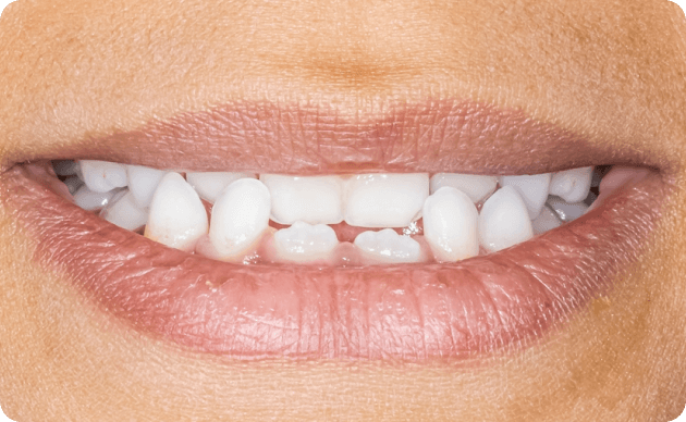 What Will Happen If It's Left Untreated?