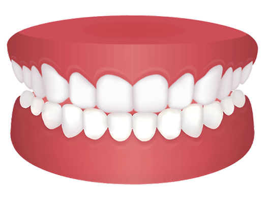 Fix Your Edge to Edge Bite With ALIGNERCO