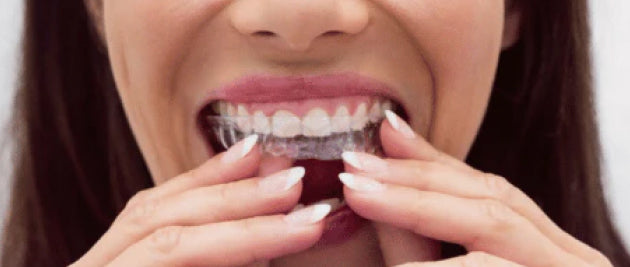 Eco-Friendly Aligners