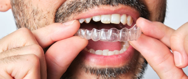 Aligner guarantee