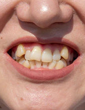 Resolve Dental Problems