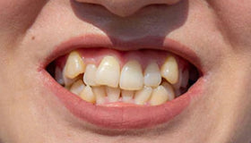 Resolve Dental Problems