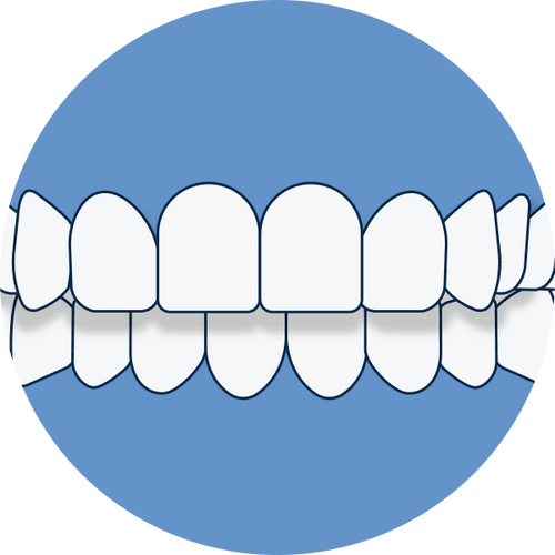 Desplazamiento de la línea media