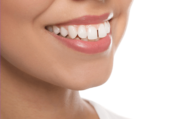 What Is An Overbite?