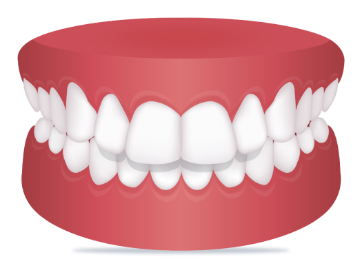 Fix Your Overbite With ALIGNERCO
