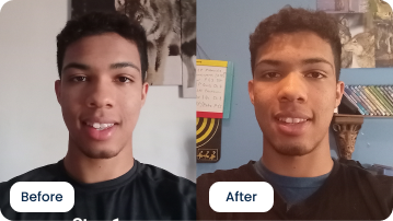 Samuel Brunson Highlights the Ease of ALIGNERCO Treatment