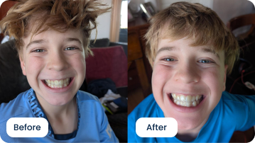 Signe Kiesel Shares His Ongoing Experience with ALIGNERCO