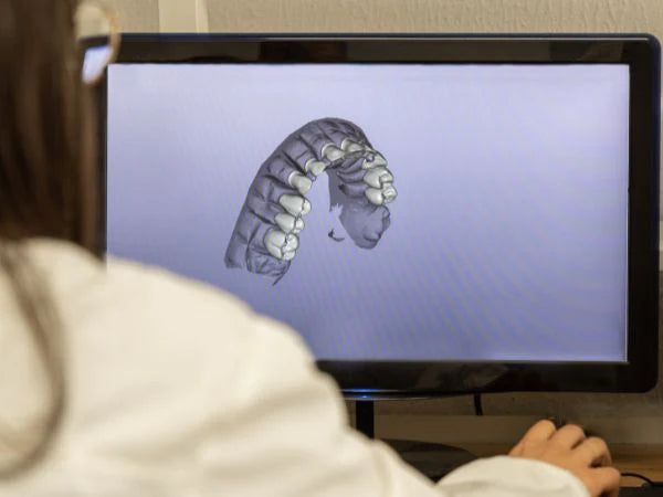 Dental Impression Storage for 2 Years