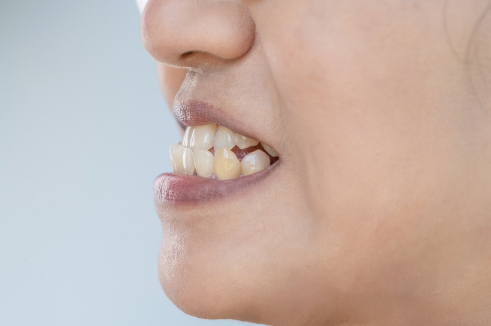 What Will Happen If It's Left Untreated?